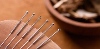 A photo of six acupuncture needles